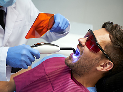 Why Men Hair Transplant